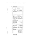 PREOPERATIVE PLANNING PROGRAM AND OPERATION SUPPORT JIG FOR HIP     REPLACEMENT ARTHROPLASTY diagram and image