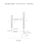 PREOPERATIVE PLANNING PROGRAM AND OPERATION SUPPORT JIG FOR HIP     REPLACEMENT ARTHROPLASTY diagram and image