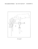 PREOPERATIVE PLANNING PROGRAM AND OPERATION SUPPORT JIG FOR HIP     REPLACEMENT ARTHROPLASTY diagram and image