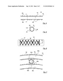 Method for Manufacturing an Optical Fiber Spool with Self-Supporting Coil     of an Optical Fiber and Optical Fiber Spool diagram and image