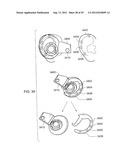 LIGHT-BASED DETECTION FOR ACOUSTIC APPLICATIONS diagram and image