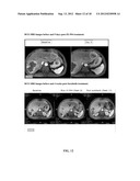 ONCOLYTIC VACCINIA VIRUS COMBINATION CANCER THERAPY diagram and image