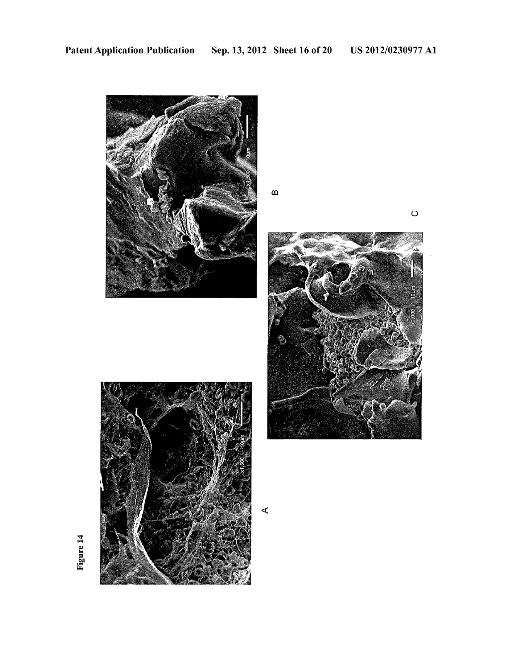 FLOWABLE COLLAGEN-BASED HEMOSTAT AND METHODS OF USE - diagram, schematic, and image 17