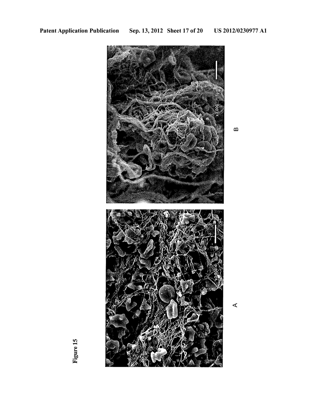 FLOWABLE COLLAGEN-BASED HEMOSTAT AND METHODS OF USE - diagram, schematic, and image 18