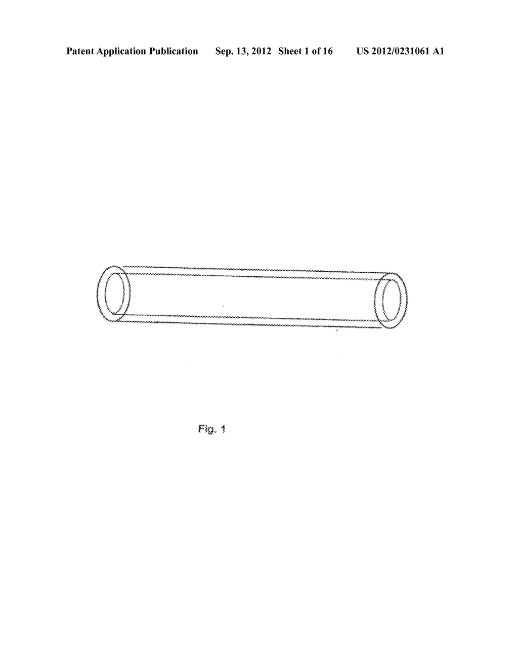 LONG TERM DRUG DELIVERY DEVICES WITH POLYURETHANE-BASED POLYMERS AND THEIR     MANUFACTURE - diagram, schematic, and image 02