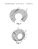 SELF-SUPPORTING INSULATING END CONE LINER AND POLLUTION CONTROL DEVICE diagram and image