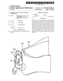 ORTHODONTIC APPLIANCE WITH LOW PROFILE CLIP diagram and image