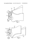 ORTHODONTIC APPLIANCE WITH LOW PROFILE CLIP diagram and image