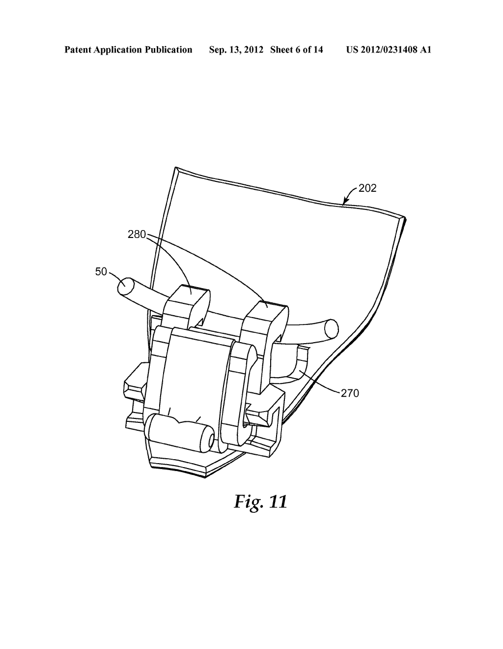 ORTHODONTIC APPLIANCE WITH LOW PROFILE CLIP - diagram, schematic, and image 07