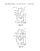 ORTHODONTIC APPLIANCE WITH LOW PROFILE CLIP diagram and image