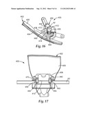 ORTHODONTIC APPLIANCE WITH LOW PROFILE CLIP diagram and image