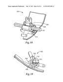 ORTHODONTIC APPLIANCE WITH LOW PROFILE CLIP diagram and image