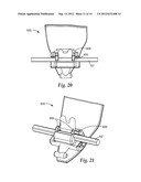 ORTHODONTIC APPLIANCE WITH LOW PROFILE CLIP diagram and image