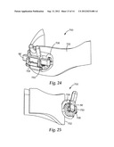 ORTHODONTIC APPLIANCE WITH LOW PROFILE CLIP diagram and image