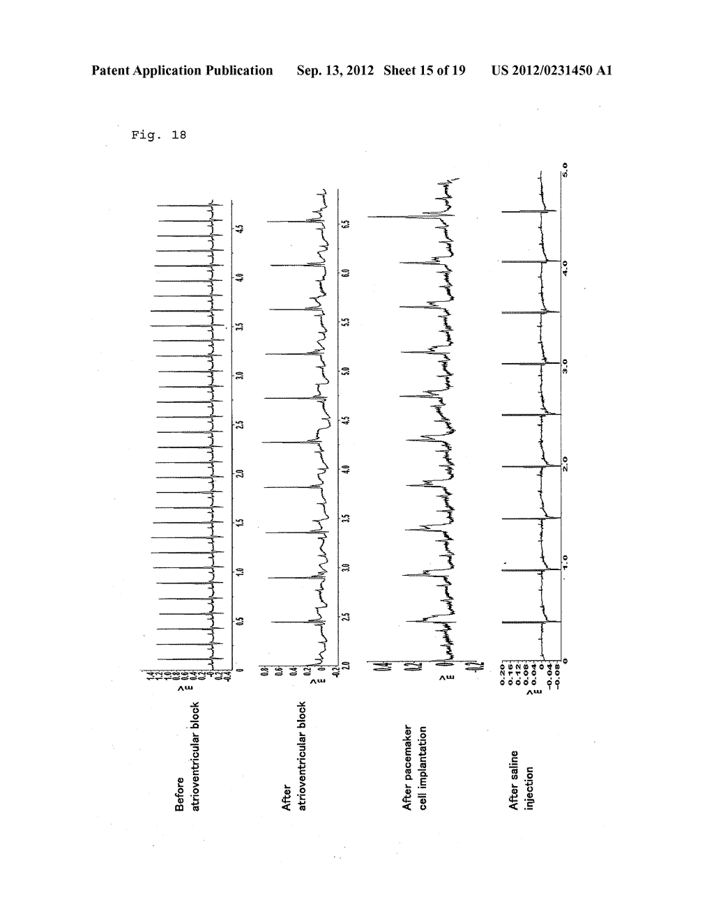 NOVEL PACEMAKER CELL - diagram, schematic, and image 16