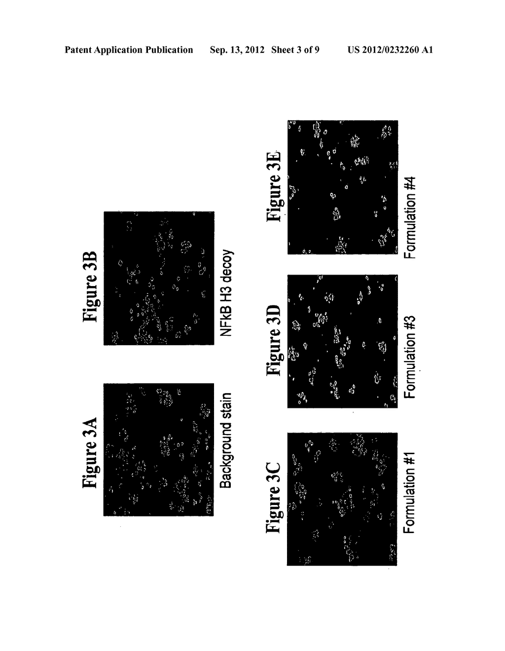 AMPHIPHILIC NUCLEOTIDE COCHLEATE COMPOSITIONS AND METHODS OF USING THE     SAME - diagram, schematic, and image 04
