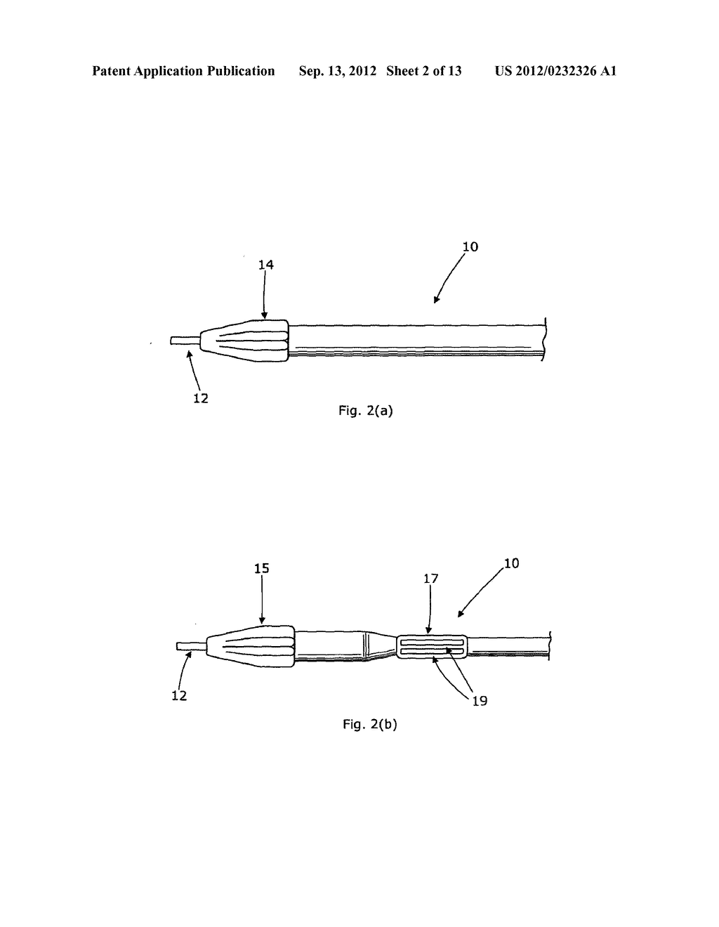 LUMENAL REMODELLING DEVICE AND METHODS - diagram, schematic, and image 03