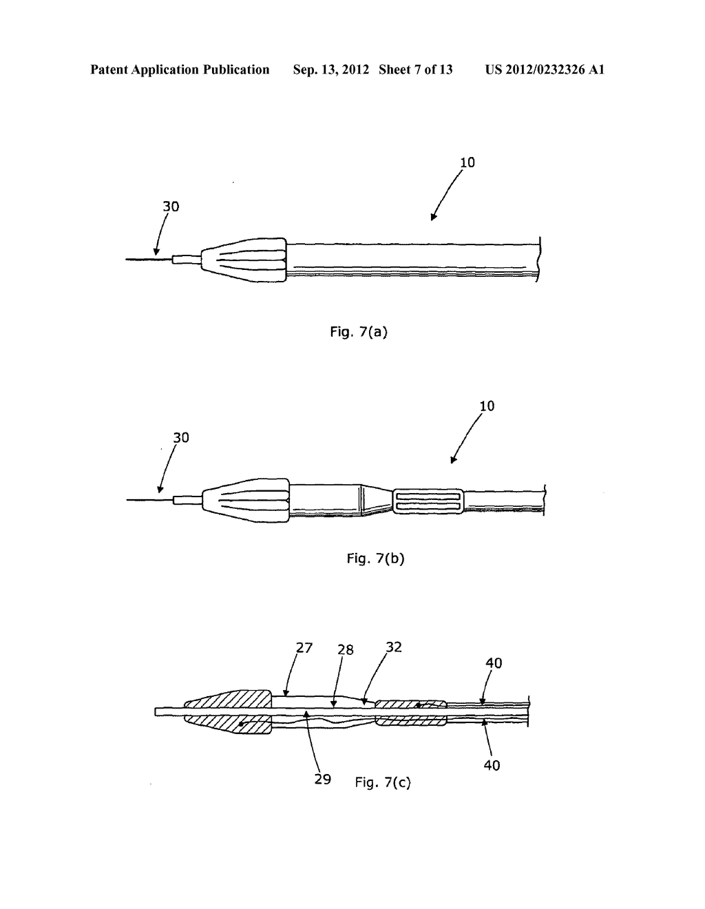 LUMENAL REMODELLING DEVICE AND METHODS - diagram, schematic, and image 08