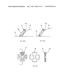 LUMENAL REMODELLING DEVICE AND METHODS diagram and image