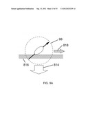 MAGNETIC-BASED METHODS FOR TREATING VESSEL OBSTRUCTIONS diagram and image