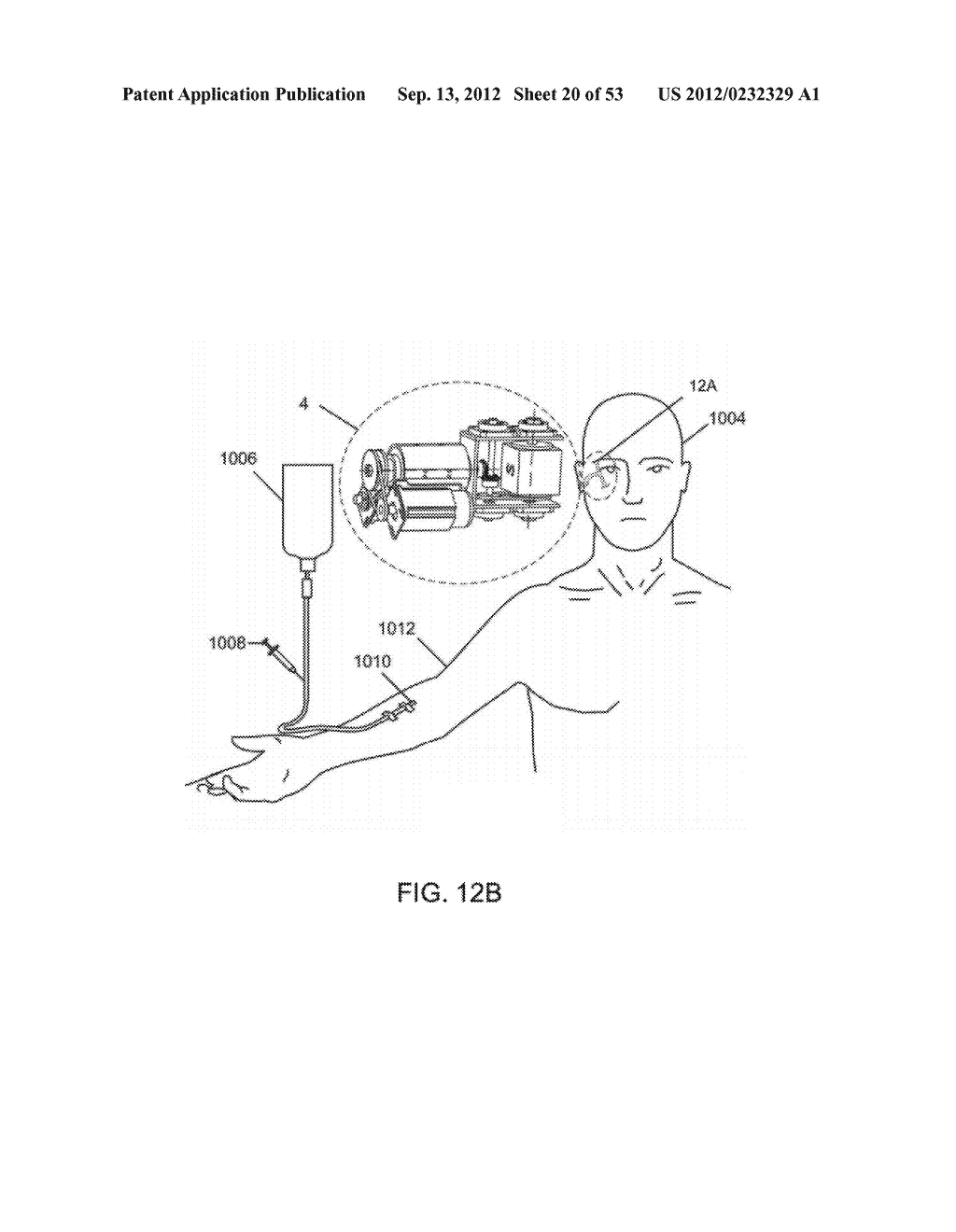 MAGNETIC-BASED METHODS FOR TREATING VESSEL OBSTRUCTIONS - diagram, schematic, and image 21