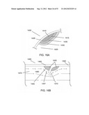 MAGNETIC-BASED METHODS FOR TREATING VESSEL OBSTRUCTIONS diagram and image