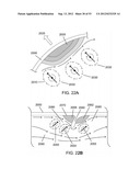 MAGNETIC-BASED METHODS FOR TREATING VESSEL OBSTRUCTIONS diagram and image