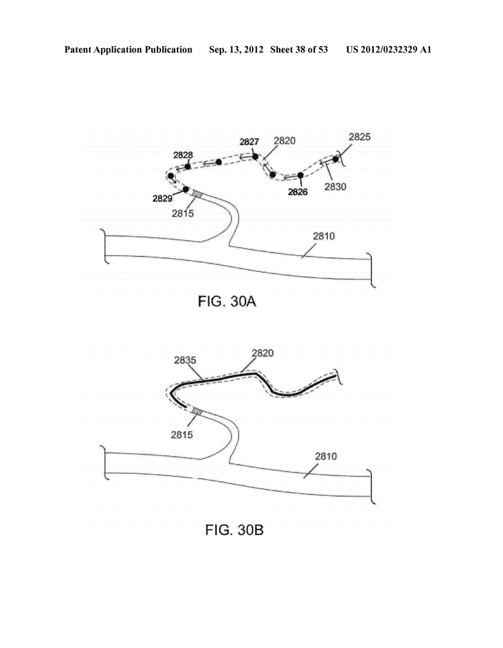 MAGNETIC-BASED METHODS FOR TREATING VESSEL OBSTRUCTIONS - diagram, schematic, and image 39