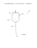 MAGNETIC-BASED METHODS FOR TREATING VESSEL OBSTRUCTIONS diagram and image