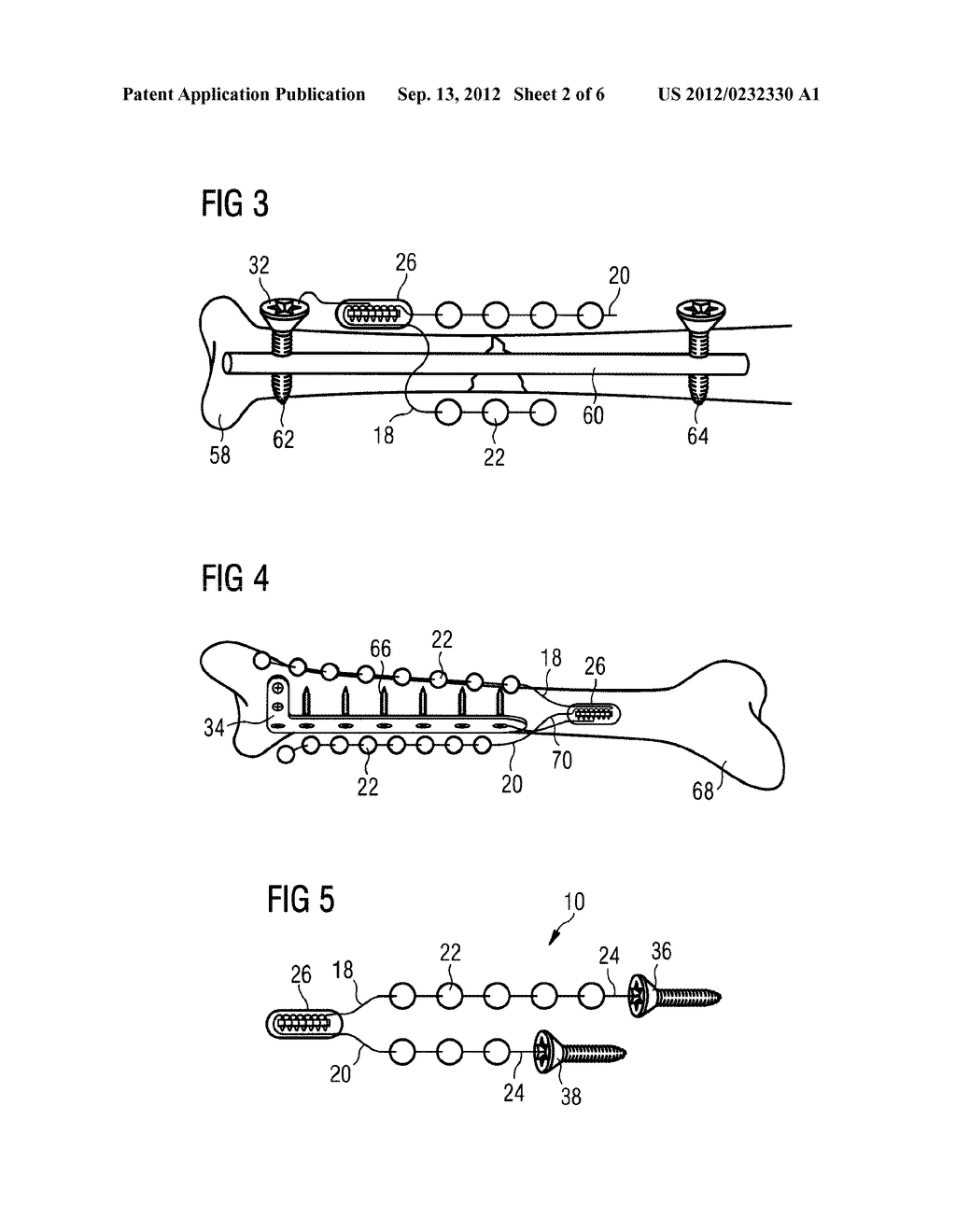 Device for Administering Drugs and for Influencing the Effects of Drugs - diagram, schematic, and image 03