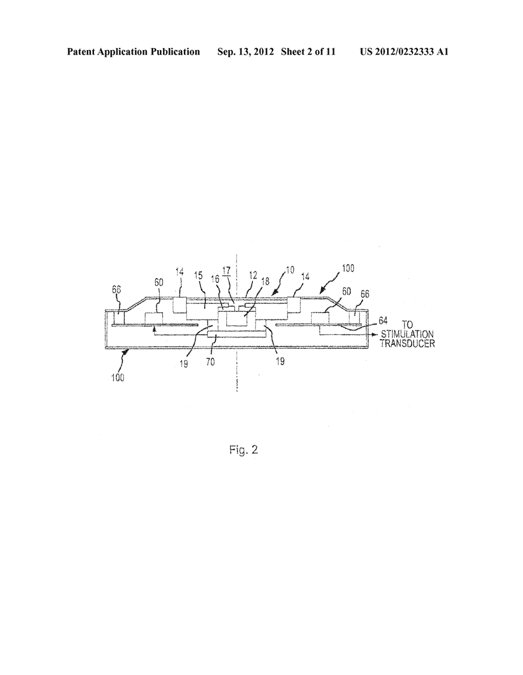 Adaptive Cancellation System For Implantable Hearing Instruments - diagram, schematic, and image 03