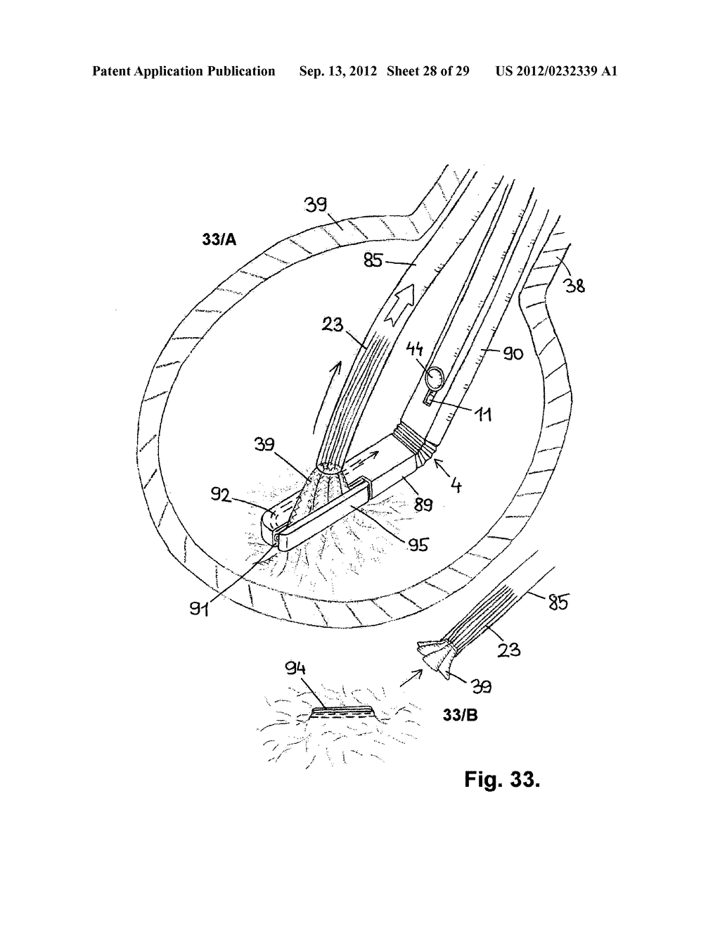 SURGICAL DEVICE AND ACCESSORIES - diagram, schematic, and image 29