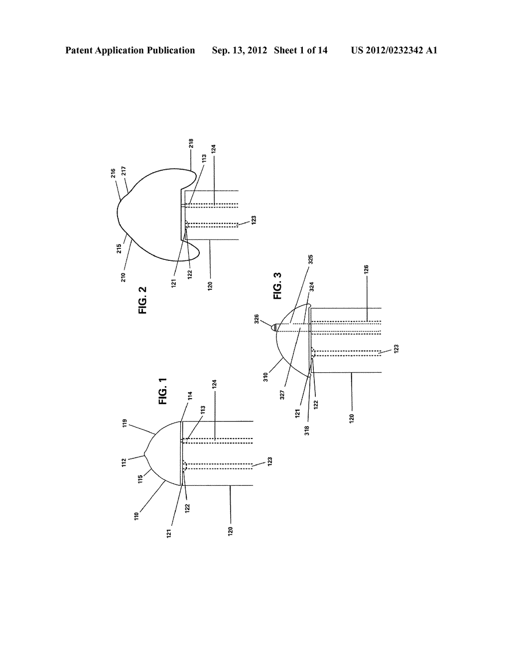 DISPOSABLE AND REUSABLE COMLEX SHAPED SEE-THROUGH ENDOSCOPE - diagram, schematic, and image 02