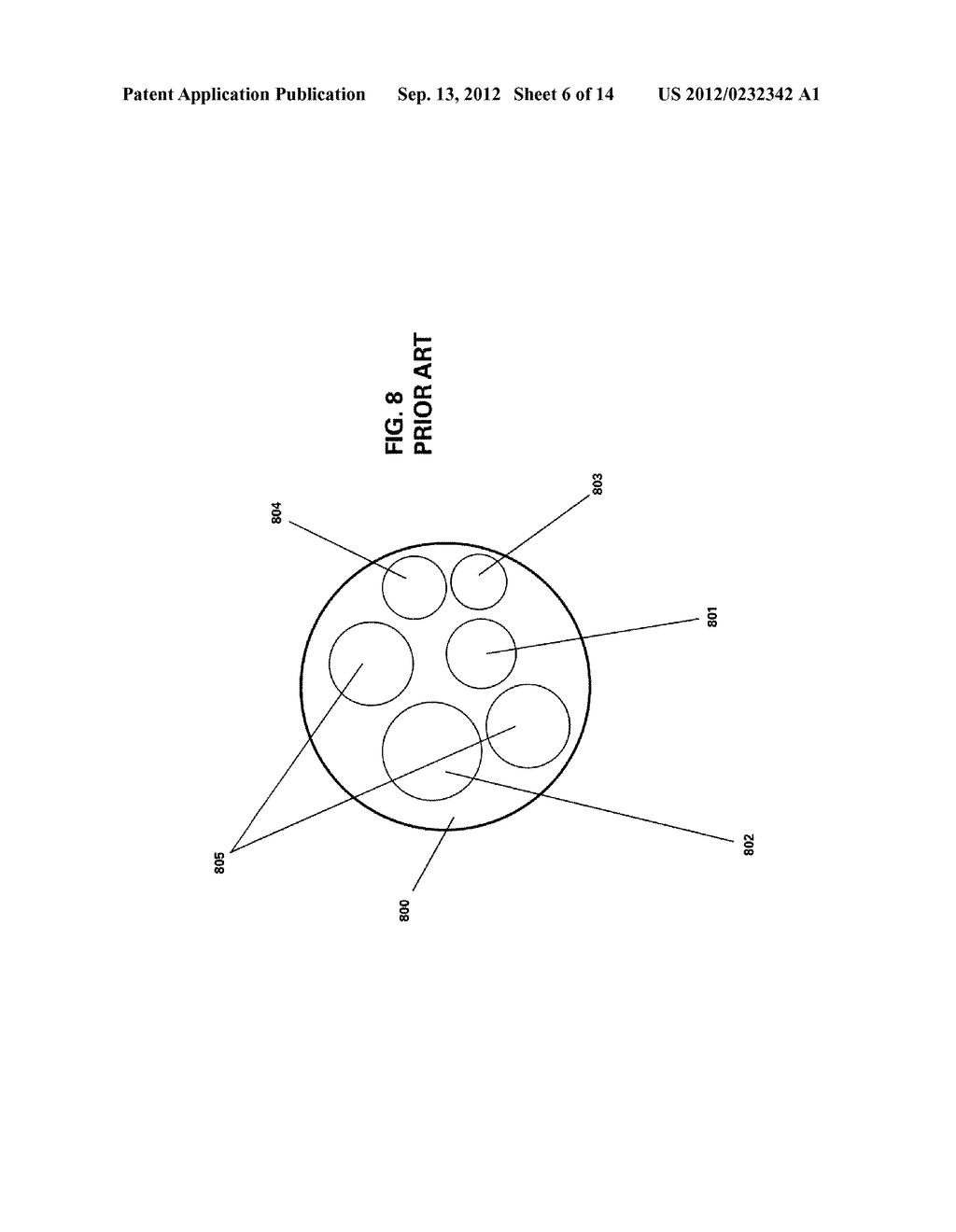 DISPOSABLE AND REUSABLE COMLEX SHAPED SEE-THROUGH ENDOSCOPE - diagram, schematic, and image 07