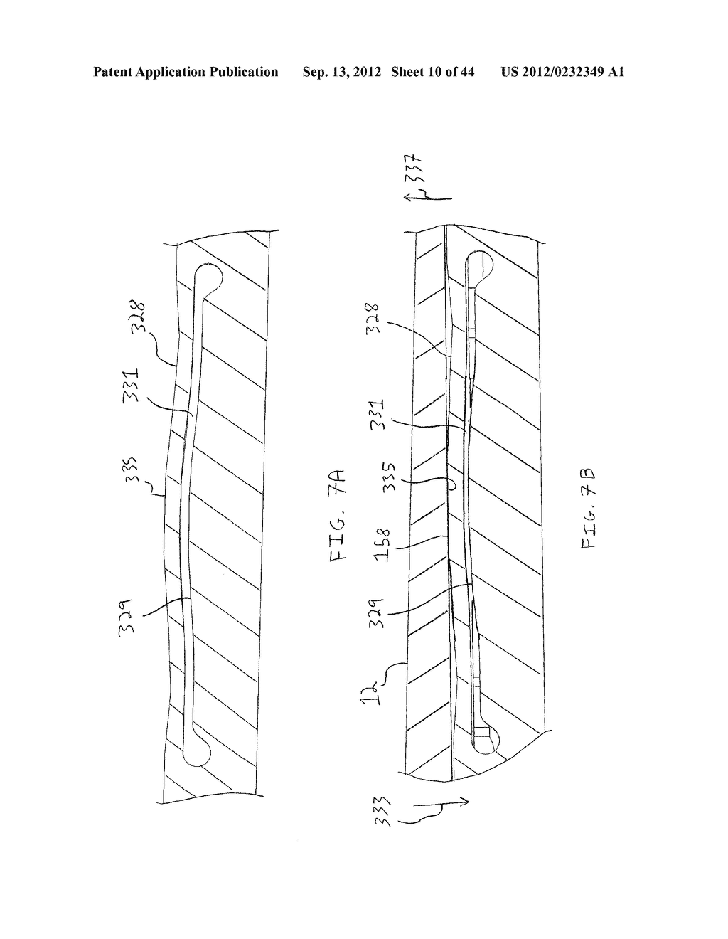 Apparatus And Method For Enlarging An Incision - diagram, schematic, and image 11