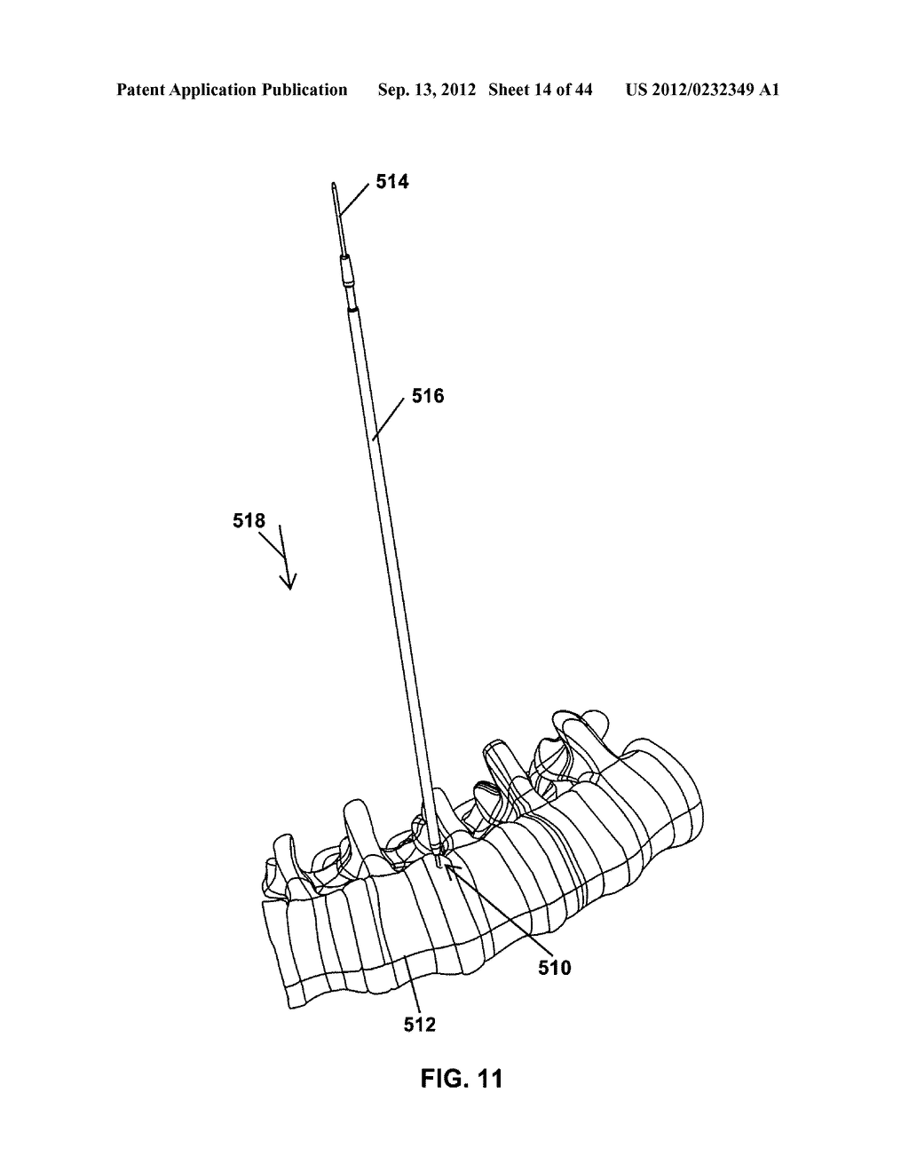 Apparatus And Method For Enlarging An Incision - diagram, schematic, and image 15