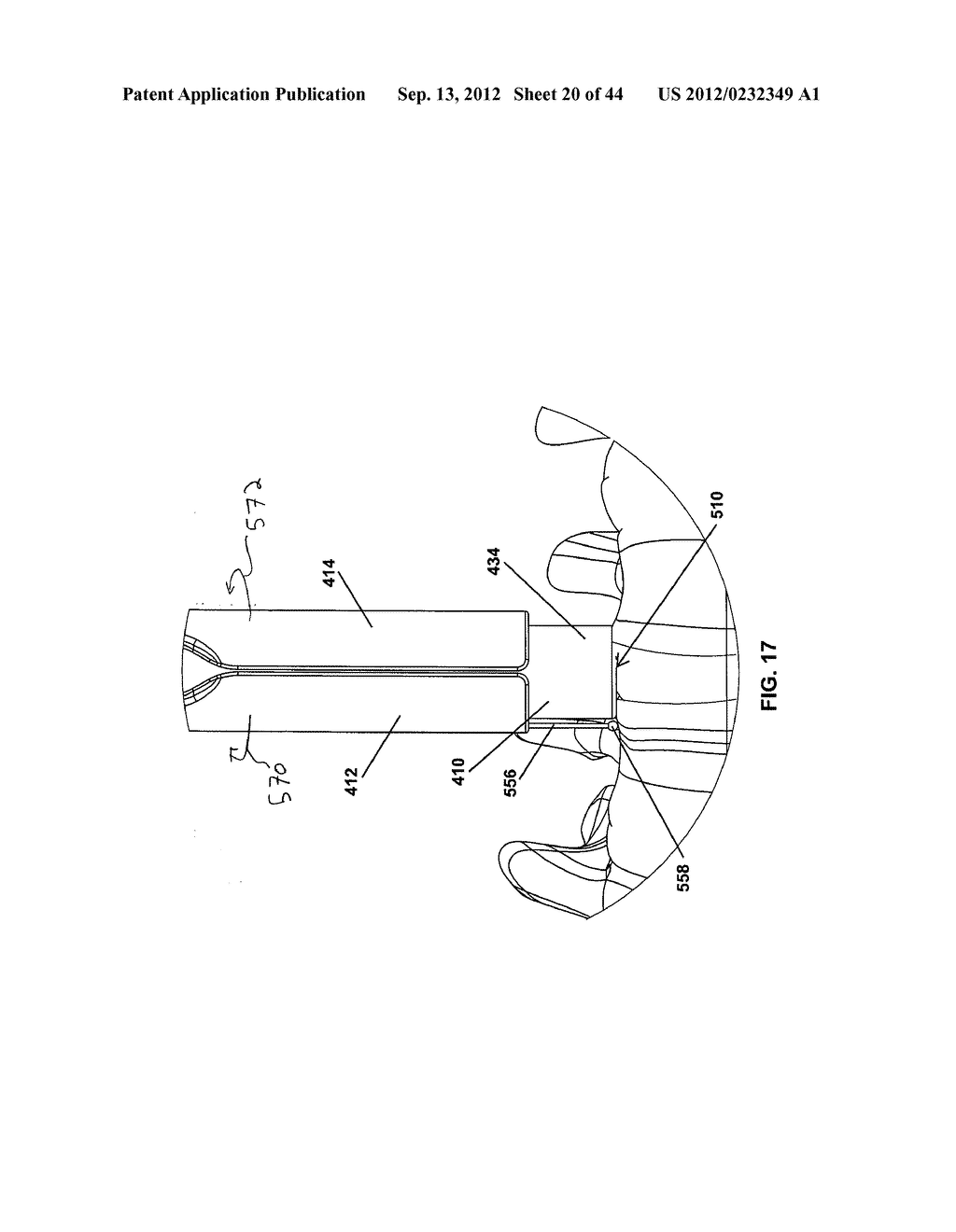 Apparatus And Method For Enlarging An Incision - diagram, schematic, and image 21