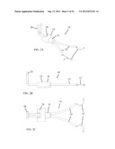 IRIS RETRACTOR diagram and image