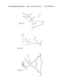 IRIS RETRACTOR diagram and image