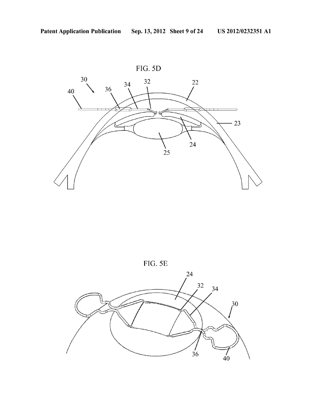 IRIS RETRACTOR - diagram, schematic, and image 10