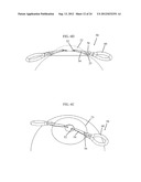 IRIS RETRACTOR diagram and image