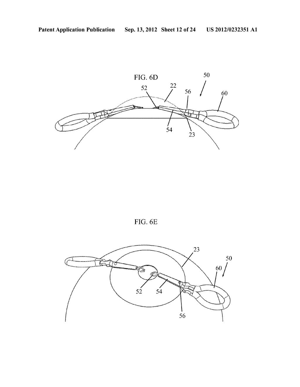 IRIS RETRACTOR - diagram, schematic, and image 13