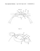 IRIS RETRACTOR diagram and image