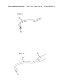 IRIS RETRACTOR diagram and image