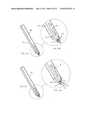 IRIS RETRACTOR diagram and image