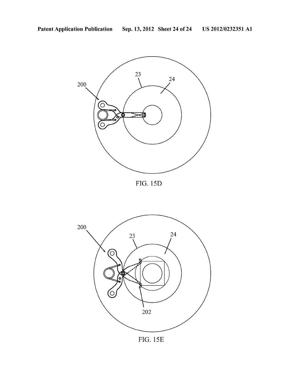 IRIS RETRACTOR - diagram, schematic, and image 25