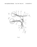 VAGINAL DILATOR HAVING SIDE BLADES OR HAVING UPPER AND LOWER BLADES     COMPRISING ACCESSORIAL BLADES diagram and image