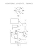 UMBILICAL PROBE SYSTEM diagram and image