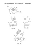 UMBILICAL PROBE SYSTEM diagram and image