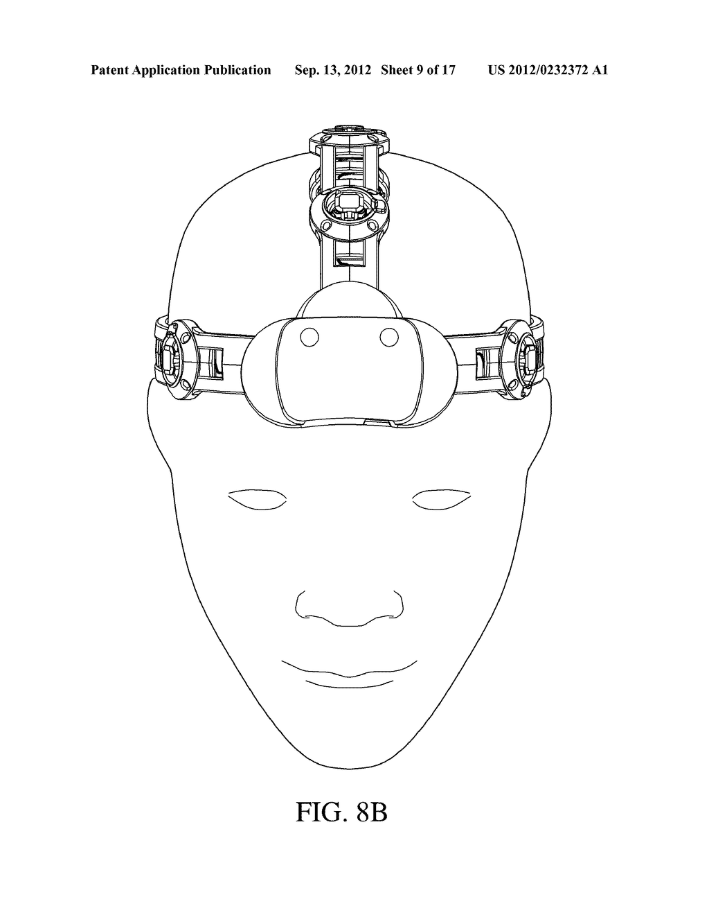 METHOD AND DEVICE FOR QUICK PRESS ON EEG ELECTRODE - diagram, schematic, and image 10